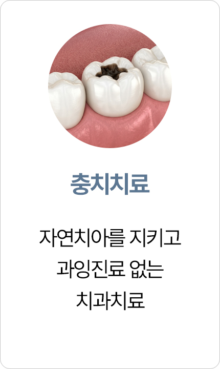연세아크로치과 충치치료