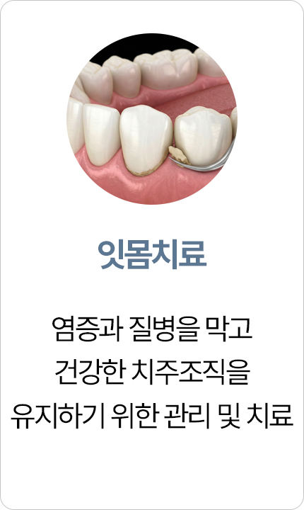 연세아크로치과 잇몸치료