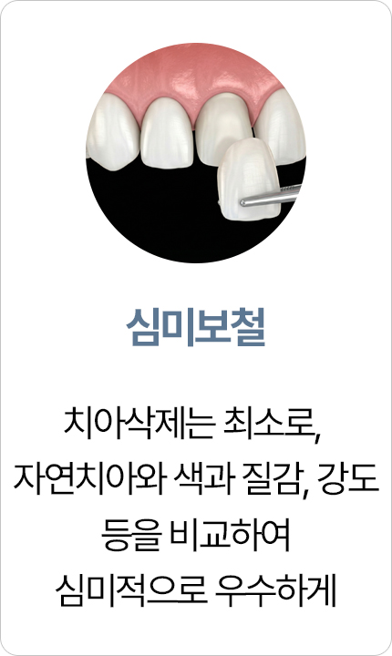 연세아크로치과 심미보철