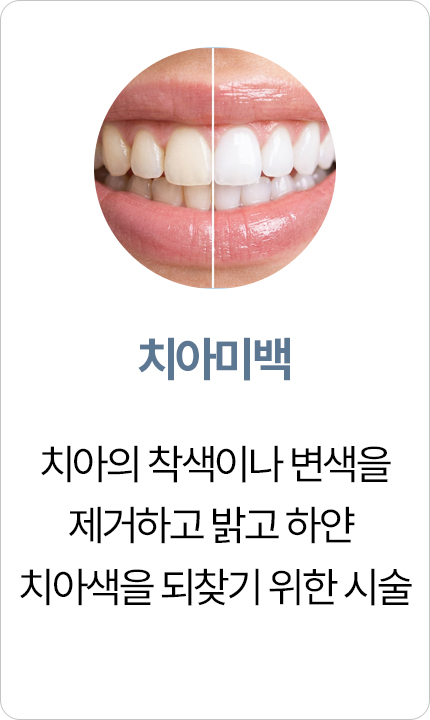 연세아크로치과 치아미백