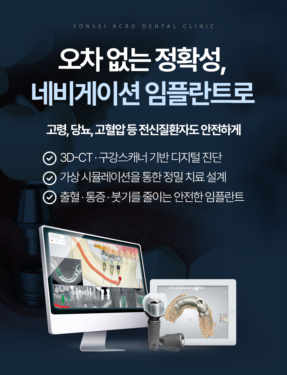 네비게이션 임플란트로 정확하고 안전한 임플란트 진료