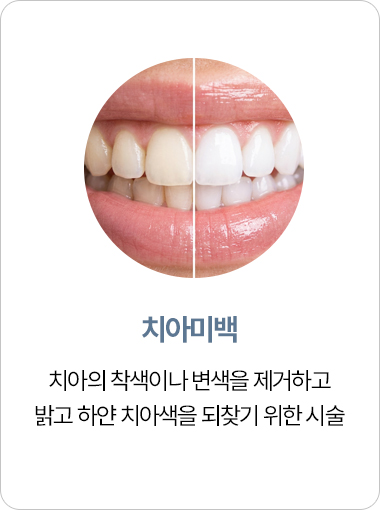 연세아크로치과 치아미백
